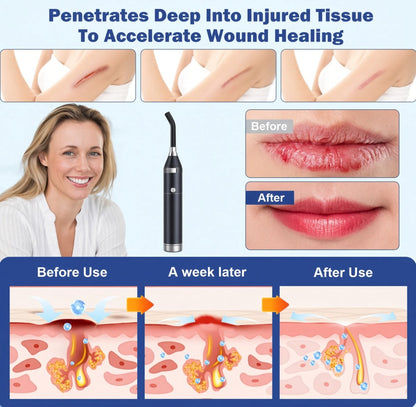 5 Wavelength RLT Pen with Precision Light Guide - GroundedKiwi.nzred light therapy red light therapybandbeltelbow