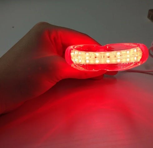 Mouth / Dental Red Light Therapy laser for Mouth Ulcers and dental health - GroundedKiwi.nz dentaldiseasegum