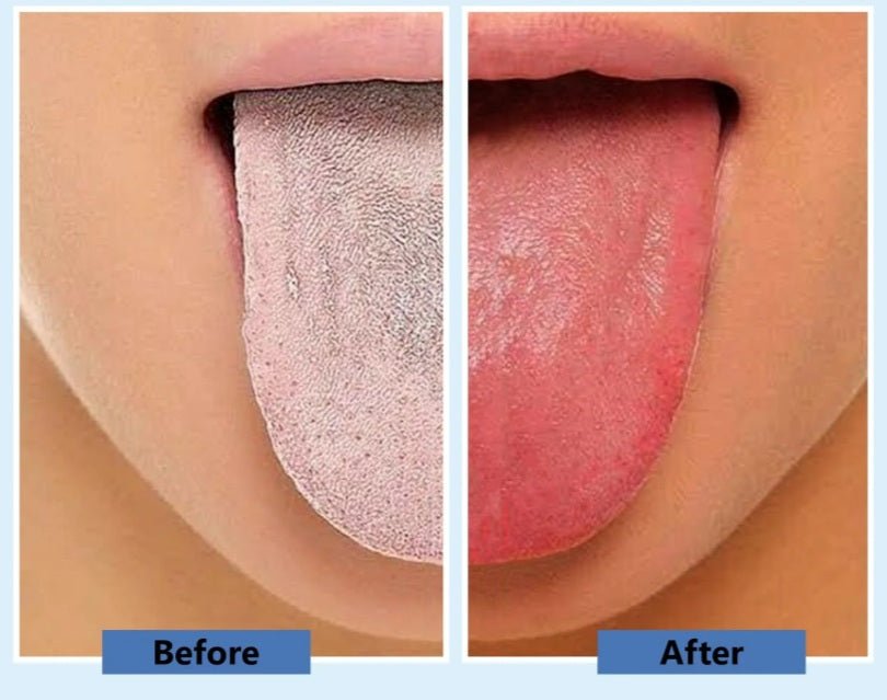 Tongue Scraper - For Oral Health - Rose Copper - GroundedKiwi.nztongue scraper tongue scraperbad breathbreathclean