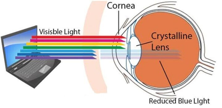 Yellow lensed Blue Light Blocking Glasses - Reduce eye strain and fatigue - GroundedKiwi.nzEyeglasses Eyeglassesanti blueblue lightcomputer glasses